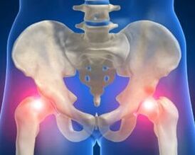 The causes of hip articulation arthrosis