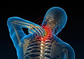 Why it develops and how cervical osteochondrosis manifests itself